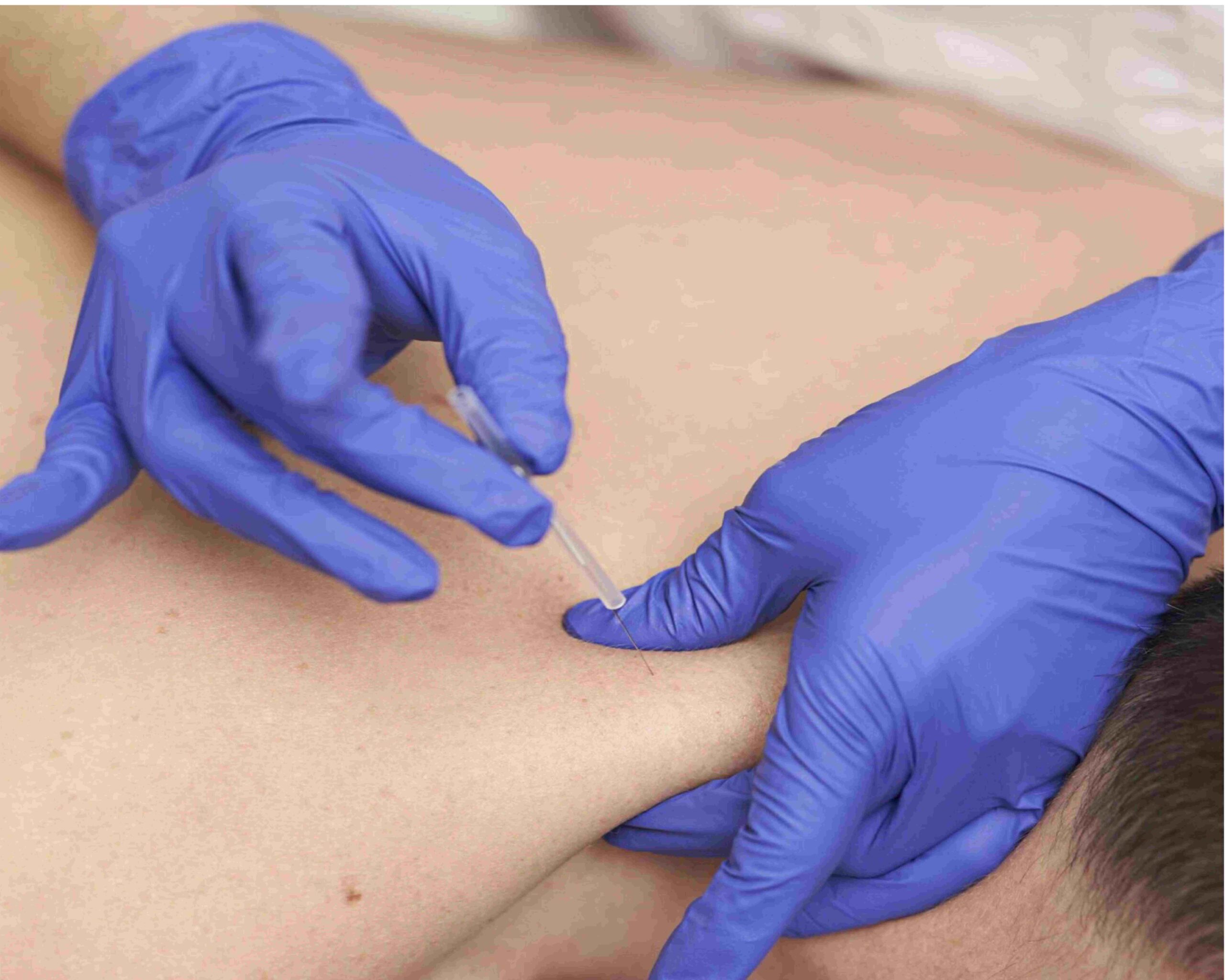 DRY compressed scaled centrekineaddict.com