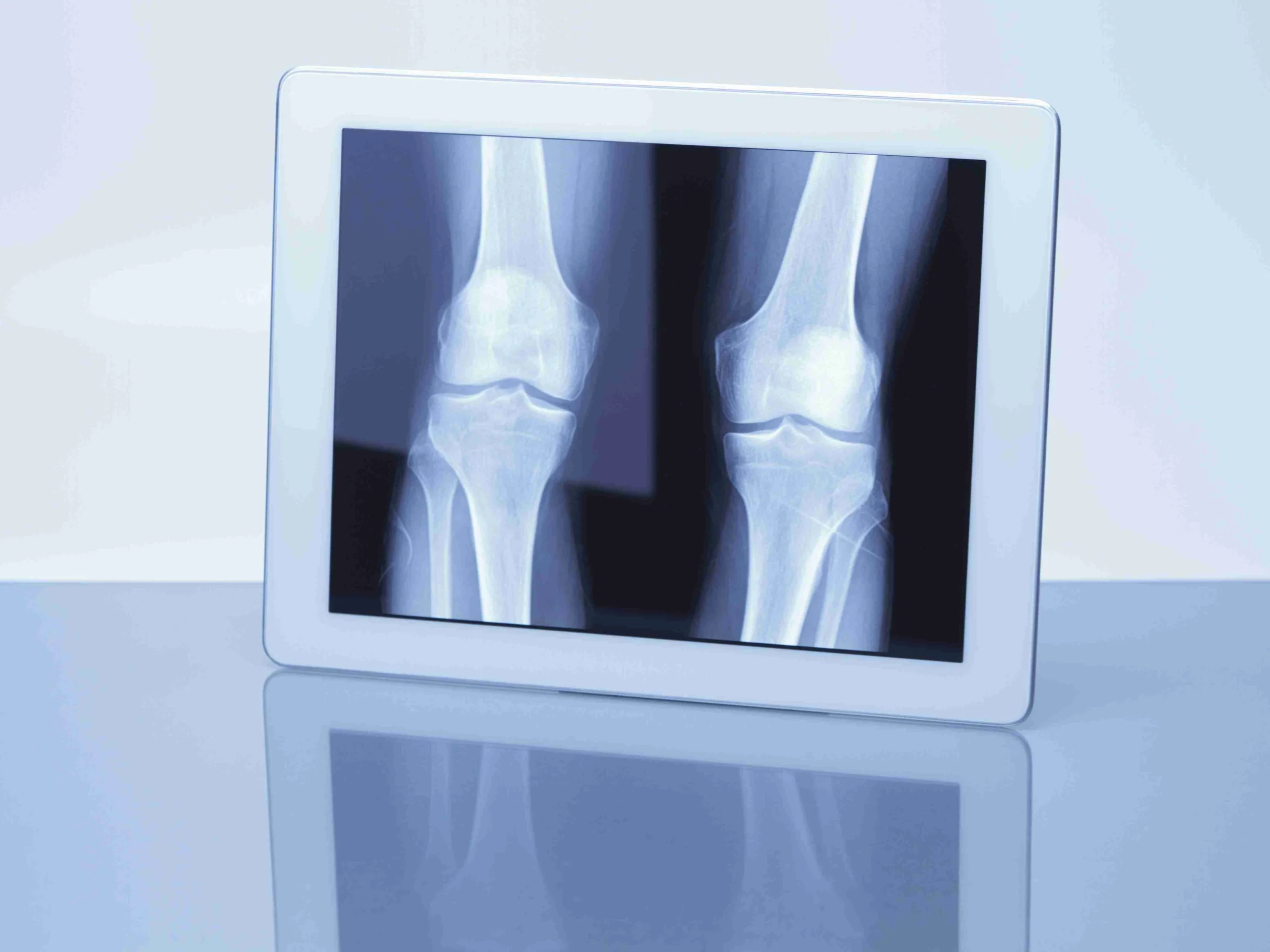 digital tablet displaying x ray image of knees 2026 01 09 08 36 50 utc compressed 1 scaled centrekineaddict.com